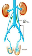 male variocele element63