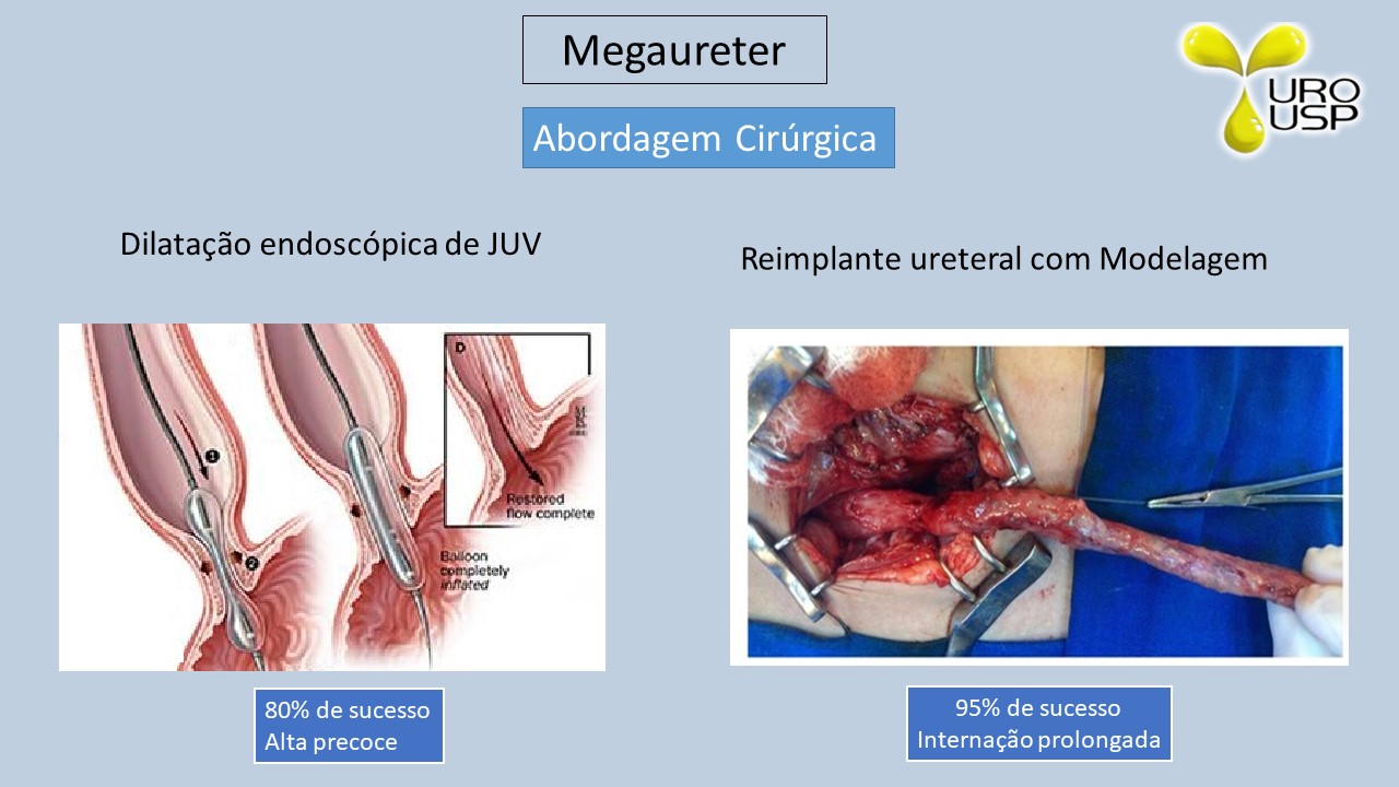 mega tratamento 