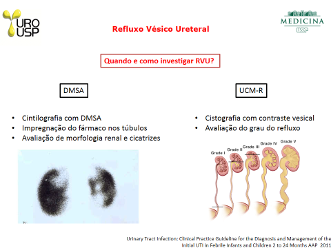 refluxo vesico ureteral 3