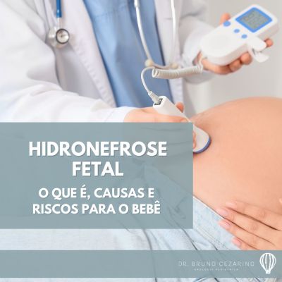 Hidronefrose Fetal